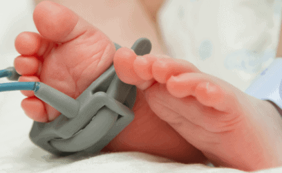 Prematüre Bebeklerde Kanguru Bakımı